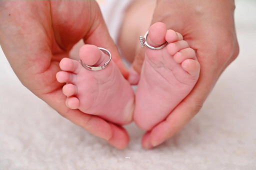 安达孕妇怎样预防妊娠纹